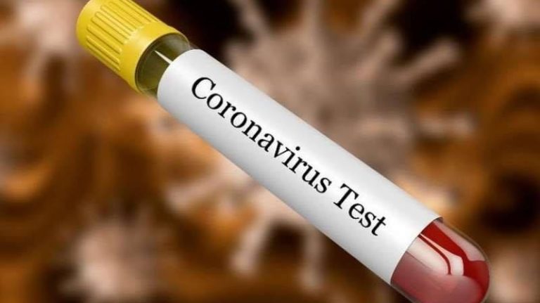coronavirus test